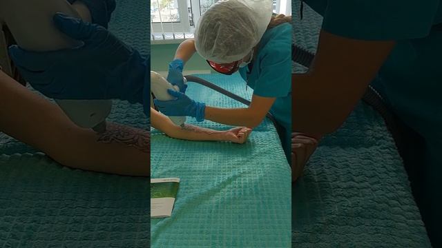 Удаление татуировки лазером смотреть онлайн