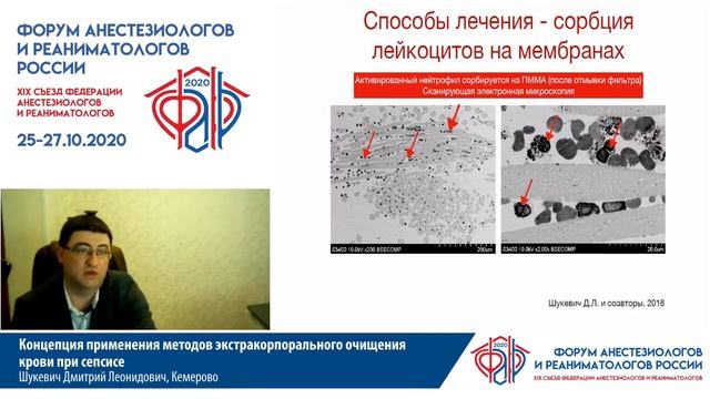 Экстракорпоральная очистка при сепсисе Шукевич Д.Л. смотреть онлайн