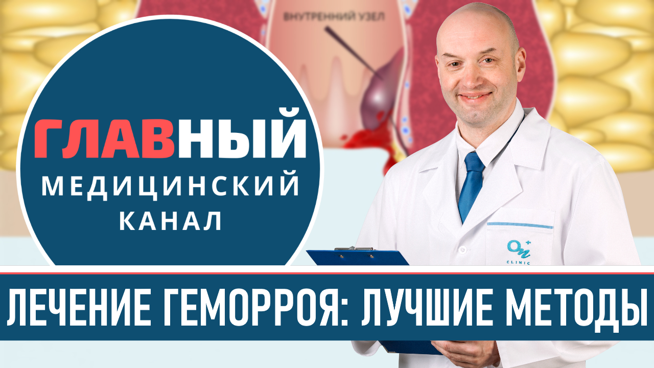 ЛЕЧЕНИЕ ГЕМОРРОЯ: лучшие эффективные методы. Как лечить геморрой у женщин и мужчин смотреть онлайн