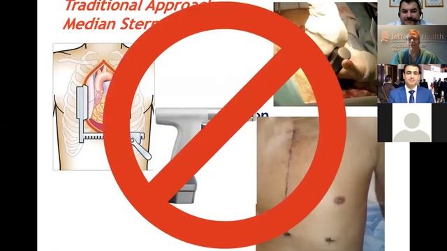 The Robotic Surgery Academy , Space Telesurgery ,Robotic Cardiac Surgery смотреть онлайн