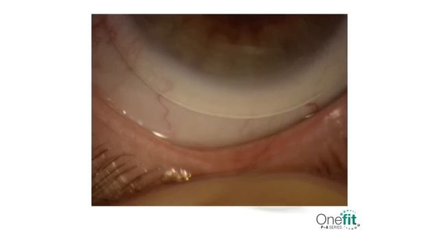 Onefit P+A смотреть онлайн