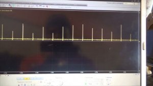 ВАЗ 2111 троит.   Проверка системы зажигания COP осциллографом мотортестером Диамаг-2.