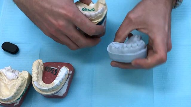 Как делаются виниры? 2 часть смотреть онлайн