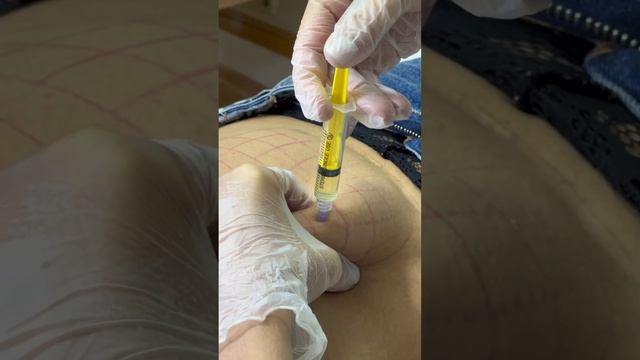 Курс «Ліполітики +. Поглиблений курс». За детальною інформацію та записом звертайтеся у Instagram ? смотреть онлайн