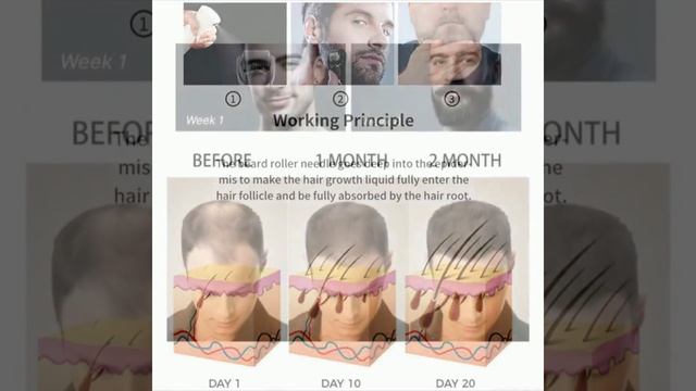 Best Derma Roller 2022 смотреть онлайн