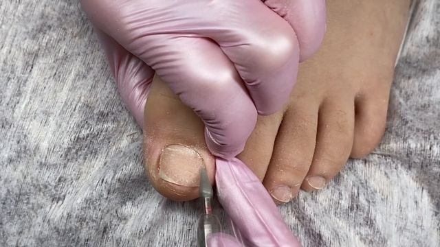 Первый педикюр в жизни? Слоящиеся ногти? Вычищаем подногтевую мозоль? Педикюр на клиенте смотреть онлайн