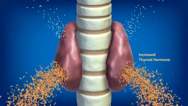 Hills y/d Thyroid Care - PetClick смотреть онлайн