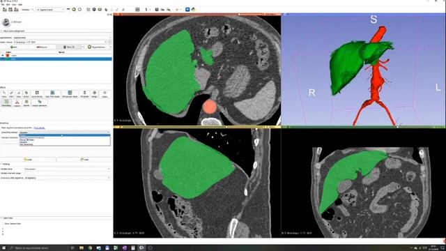 3D Slicer Tutorial смотреть онлайн