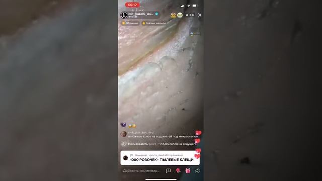 Какие ногти под микроскопом!? смотреть онлайн