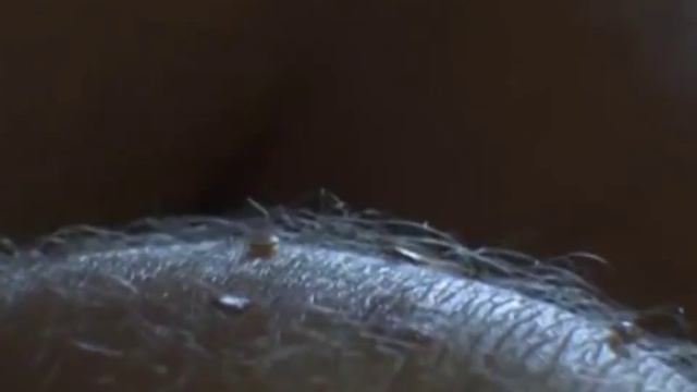 Дезинфекция квартиры от клопов смотреть онлайн