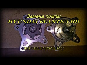 Замена помпы Hyundai Elantra HD (J4)