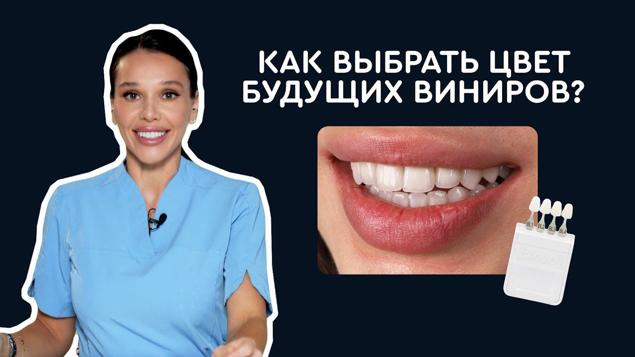Виниры | Какой цвет подойдет именно мне?