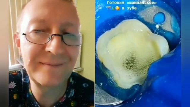 Что там, ВНУТРИ ЗУБА!🔥🤓 смотреть онлайн