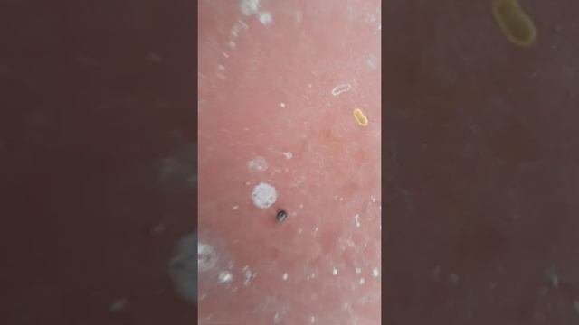 Пчеловодство 2022 года. Чёрные жучки внутри мертвого трутня смотреть онлайн