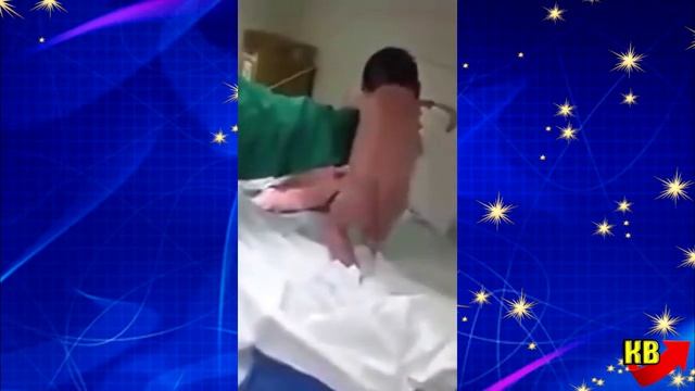 Новорожденный ребенок пошел сразу после родов! Видео