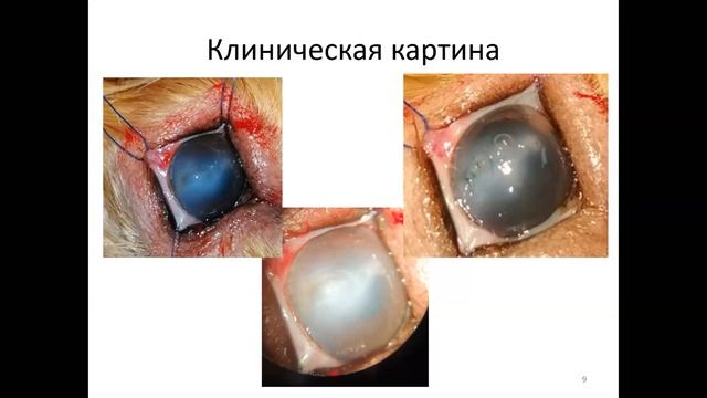 Скальпированные ранения роговицы смотреть онлайн