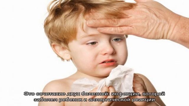 Формы и симптомы аллергического ринита у детей. Лечение аллергического насморка и заложенности нос. смотреть онлайн