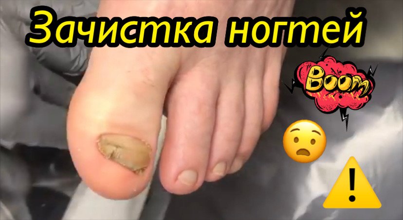 Зачистка ногтей????⚠️? смотреть онлайн