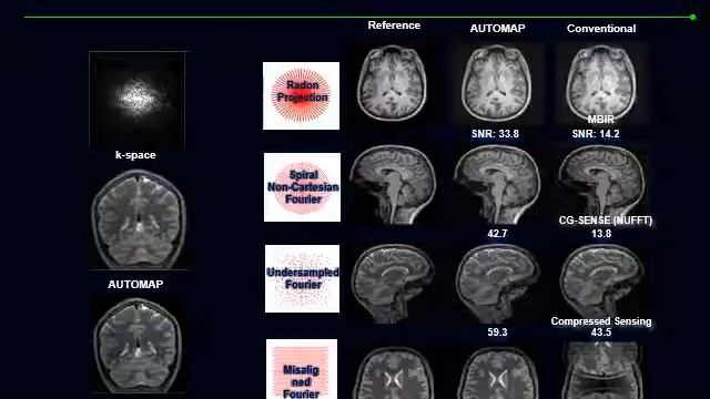 P3 SMRA educational lecture shanshan wang AI driven MRI reconstruction смотреть онлайн