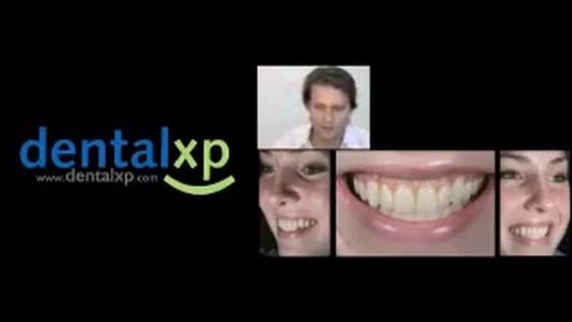 Dental XP смотреть онлайн