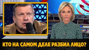 Стало известно кто разбил лицо Владимиру Соловьеву