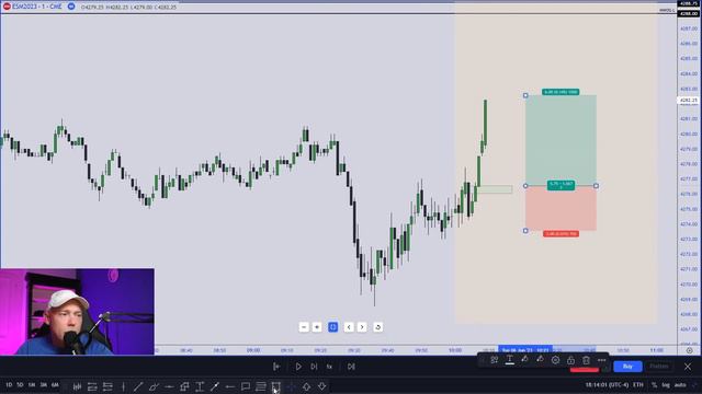 ICT Silver Bullet Strategy - It's unreal how accurate it is. All 3 sessions Explained with Example смотреть онлайн