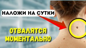 Папилломы отпадут 1000%.Самый простой и дешевый  способ удаления висячих родинок в домашних условиях