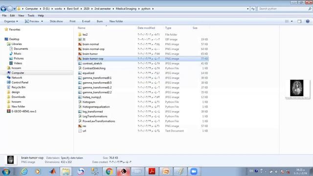 lecture 2 lab1 python medical images spyder open cv, Log Transform, Power-Law, Contrast Stretchin смотреть онлайн