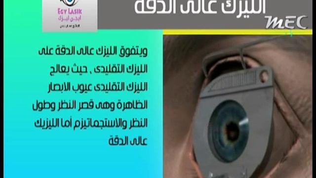 الليزك عالي الدقة أو الليزك التفصيلي - Custom Vue Lasik смотреть онлайн