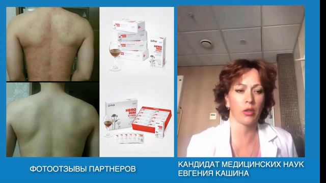 Доктор Кашина о Хемохим  Отзыв врача о Хемохим