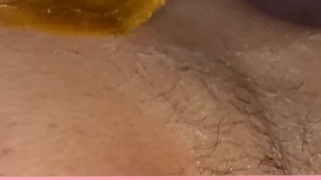 Удаление волос сахаром. Шугаринг. смотреть онлайн