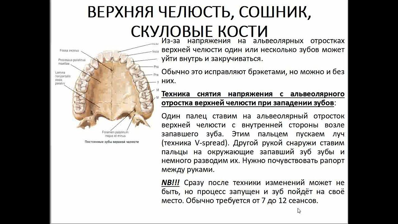 05 Семинар ЛИЦЕВОЙ ЧЕРЕП верхняя челюсть, сошник, скуловые кости смотреть онлайн