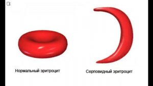 почему повышен билирубин и что с этим делать ?