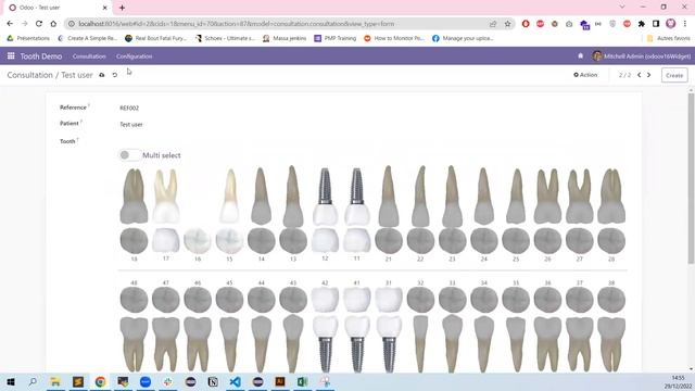 Odoo Owl component: Teeth select operation for dental practice management software смотреть онлайн