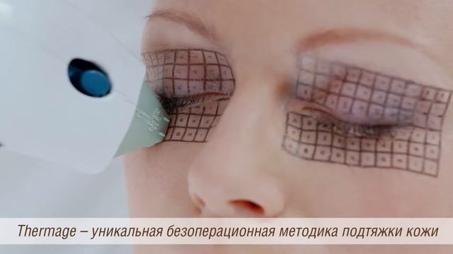 Thermage (Термаж) - радиочастотный лифтинг