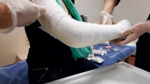 Как накладывать «пластиковый гипс» после вывиха предплечья