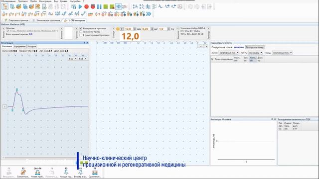 Электромиография