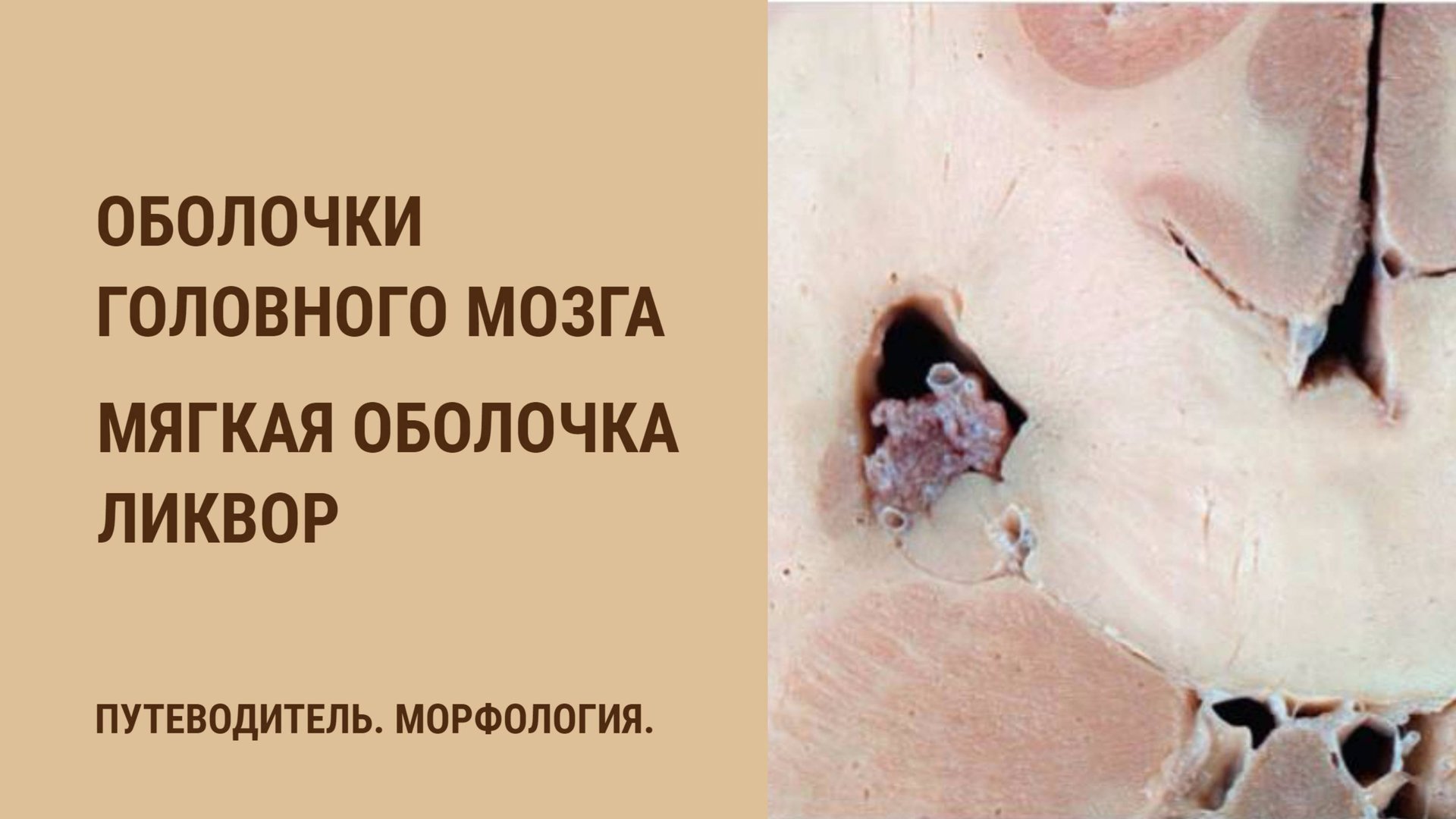 Оболочки головного мозга. Мягкая оболочка. Ликвор смотреть онлайн