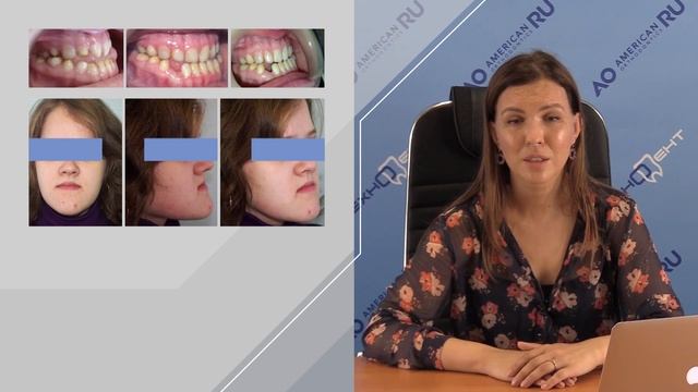 Наталья Малахова - ОСНОВНЫЕ ПРИНЦИПЫ В ДИАГНОСТИКЕ И ЛЕЧЕНИИ МЕЗИАЛЬНОЙ ОККЛЮЗИИ (часть 2) смотреть онлайн