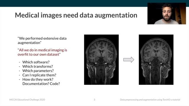 Data Preprocessing and Augmentation Using TorchIO: A Tutorial смотреть онлайн