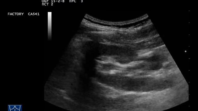 Мой фильм 18