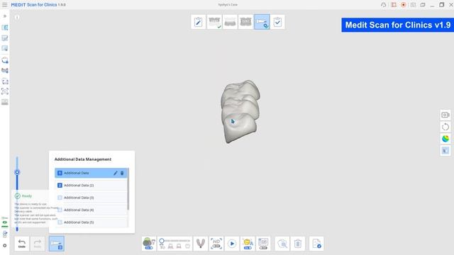 What's new in Medit Scan for Clinics v1.9 смотреть онлайн