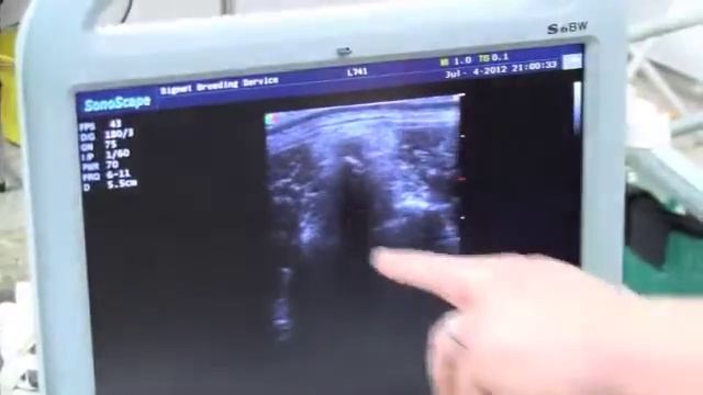 Sheep 2012: Backfat scanner to bring improvements? смотреть онлайн