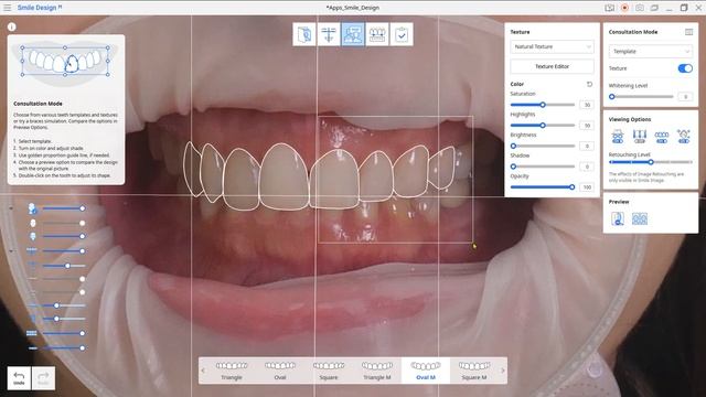 Workflow guide on how to design smile with Medit 'Smile Design' App смотреть онлайн