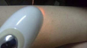 Как работает Лазерный эпилятор  RIO Scanning Hair Removal X60?