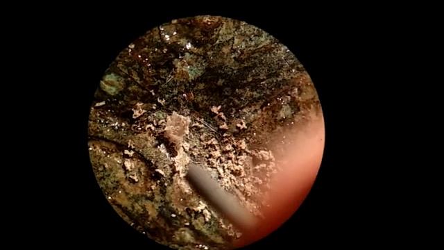 Механическая чистка монеты,аверс,антика смотреть онлайн