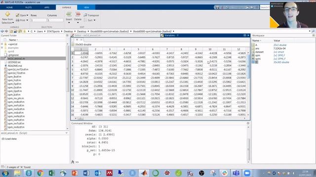 Statistical Parametric Mapping (SPM): ANOVA & Others смотреть онлайн