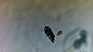 микробы под микроскопом , видео с веб-камеры кто-то кого-то ест микробы