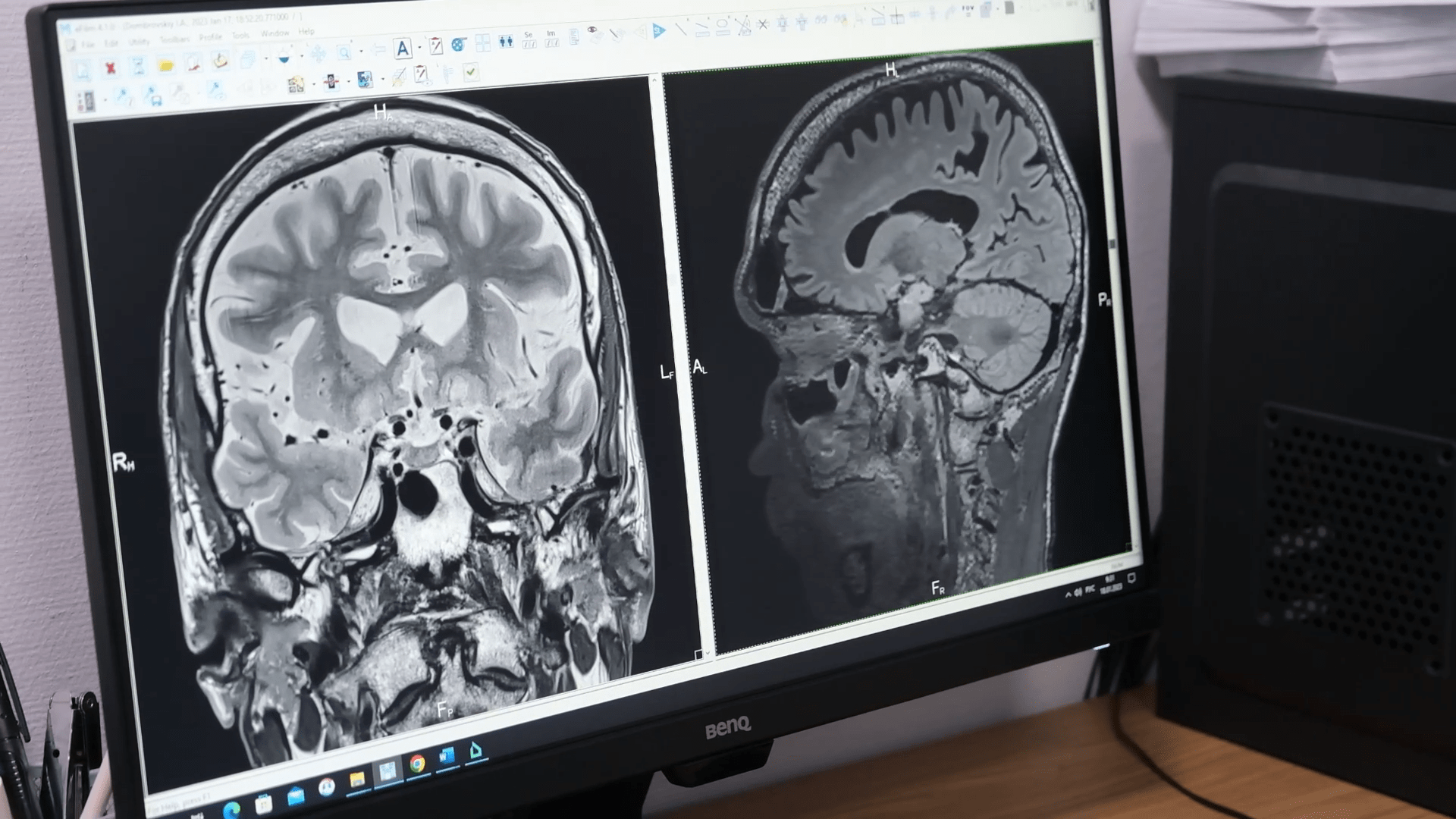 Валерию Фалькову показали разработки исследователей крупнейшего в России Научного центра неврологии смотреть онлайн
