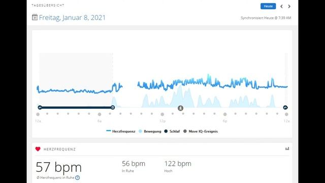 Garmin Venu SQ Music Praxisbericht | was kann sie wirklich | Review | Deutsch смотреть онлайн